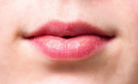 normale Lippen hd